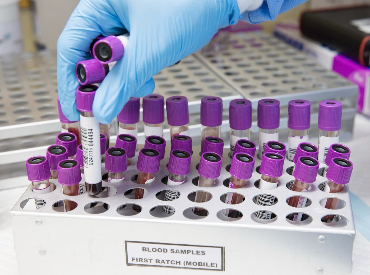 Mão com luva retirando tubos de coleta de sangue de uma estante de laboratório